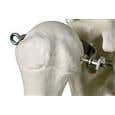 Stan-Standard Skeleton W/Pelvic Roller Stand