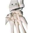 Stan-Standard Skeleton W/Pelvic Roller Stand