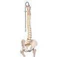 Vertebral Column &amp; Femoral Heads