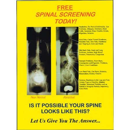 Spinal Screening Poster 24"X36"
