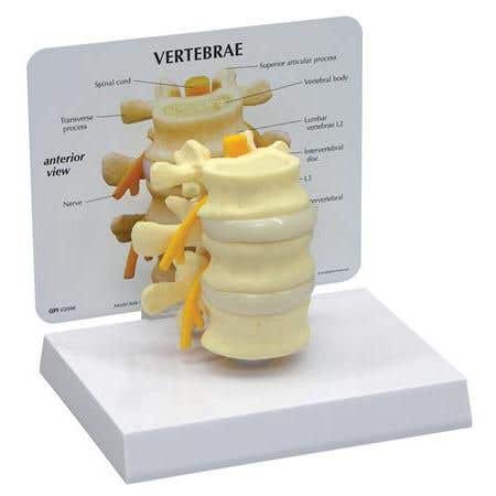 3 Piece Vertebrae With Key Card - Model