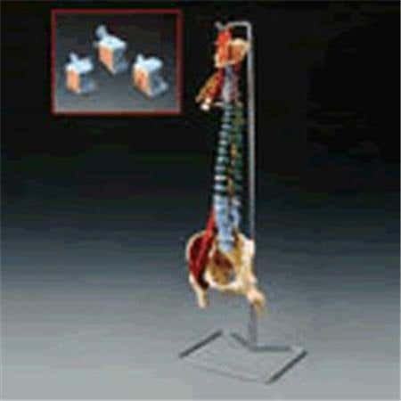 Muscle Spine With Disorders With Stand