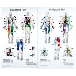 Sclerotome Pain Charts 22" X 36" Set Of 2
