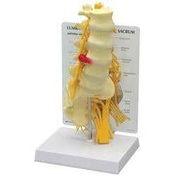 5 Piece Lumbar Vertebrae With Sacrum