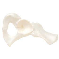 Hip Bone, Right