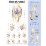 Knee Injury Chart 20" X 26" Styrene Plastic