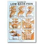 Causes Of Low Back Pain Poster 24" X 36" Laminate