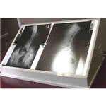 Desktop X-Ray View Box Model 105