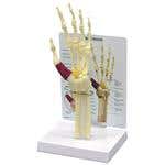 Hand/Wrist Carpal Tunnel Syndrome with Key Card