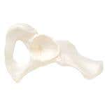Hip Bone, Right