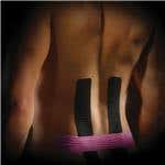 Kinesio Tex Precut - Back Application