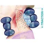 ChiroTrac DT With Cold Therapy