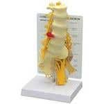 5 Piece Lumbar Vertebrae With Sacrum