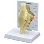 Basic Knee Model W/Key Card 100