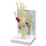 Hand/Wrist Carpal Tunnel Syndrome W/ Key Card