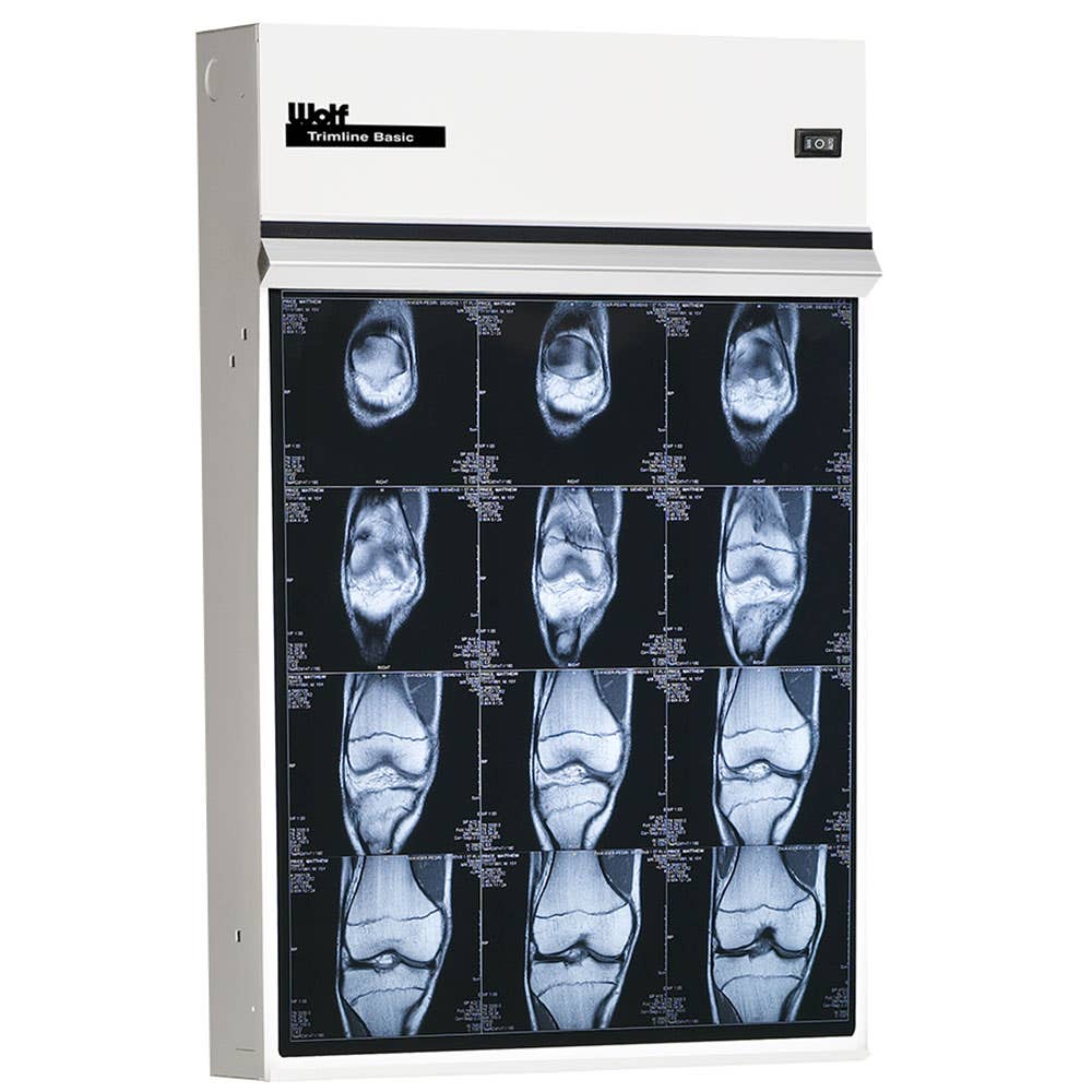 WolfX-RayTrimlineBasicIlluminator