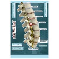 BodyPartChart Spine Conditions - Labeled Wall Decal