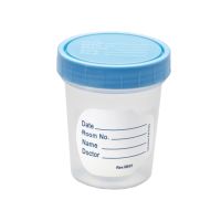 Non-Sterile Specimen Containers