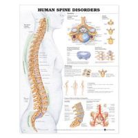 Human Spinal Disorders Poster - 20 x 26 Laminate