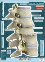 BodyPartCharts™ Subluxation - Labeled Wall Decal