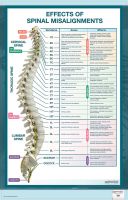 BodyPartChart™ Effects Of Spinal Misalignments