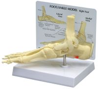 Ankle/Foot Plantar Fasciitis with Key Card