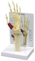 Hand/Wrist Carpal Tunnel Syndrome with Key Card