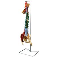 Muscle Spine With Disorders Model With Stand