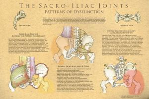 The Sacroiliac Joints: Patterns Of Dysfunction