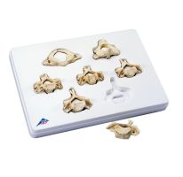 Cervical Vertebrae-Set Of 7