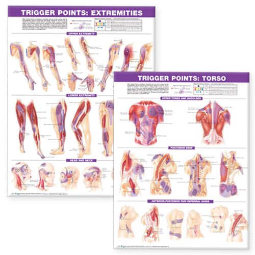 Laminated Trigger Points, Torso And Extremities