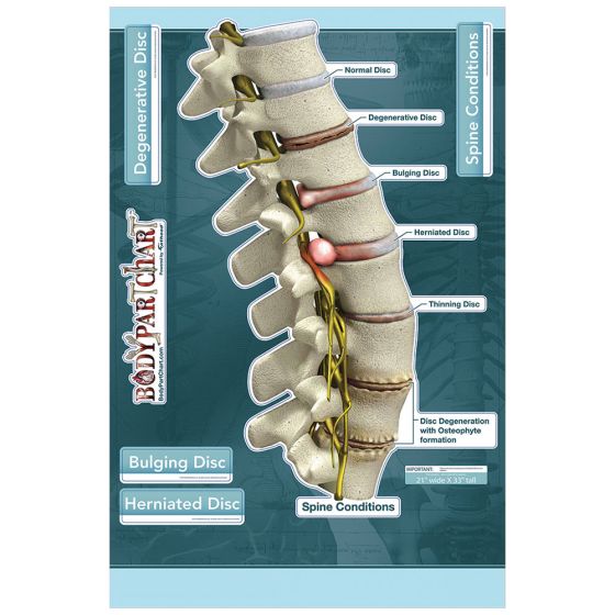 BodyPartChart&trade; Spine Conditions - Labeled Wall Decal