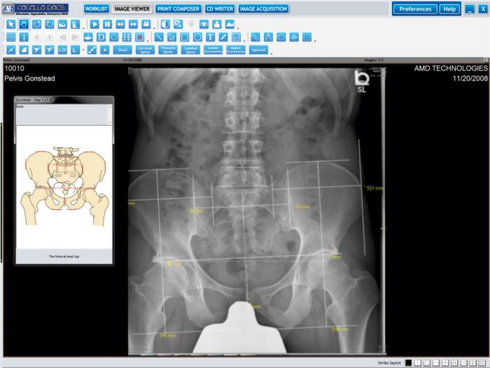 Catella LA Clinical Imaging Line Analysis Program