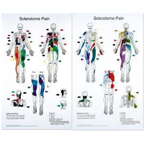 Sclerotome Pain Charts 22 X 36 Set Of 2
