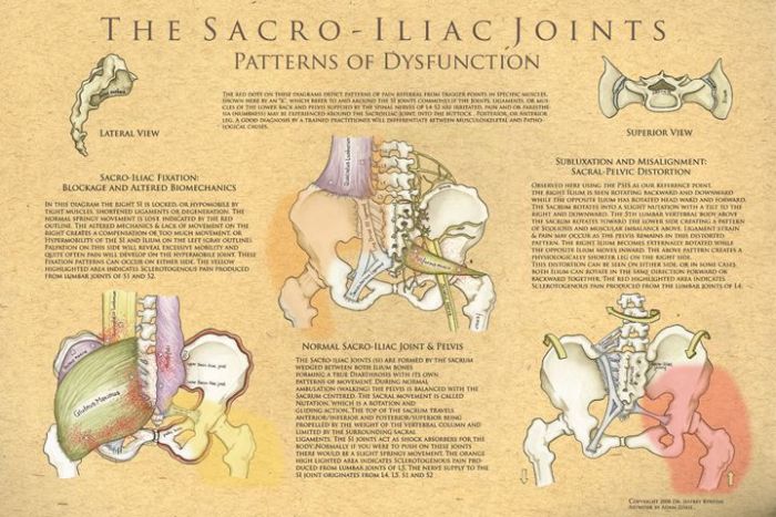 The Sacroiliac Joints: Patterns Of Dysfunction