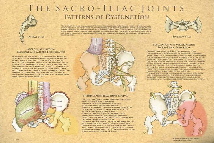 The Sacroiliac Joints: Patterns Of Dysfunction