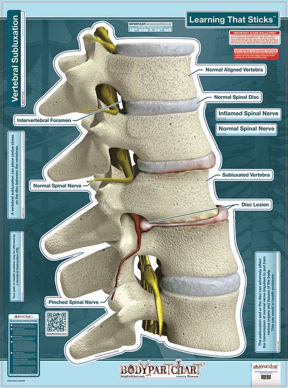 BodyPartCharts™Subluxation-LabeledWallDecal
