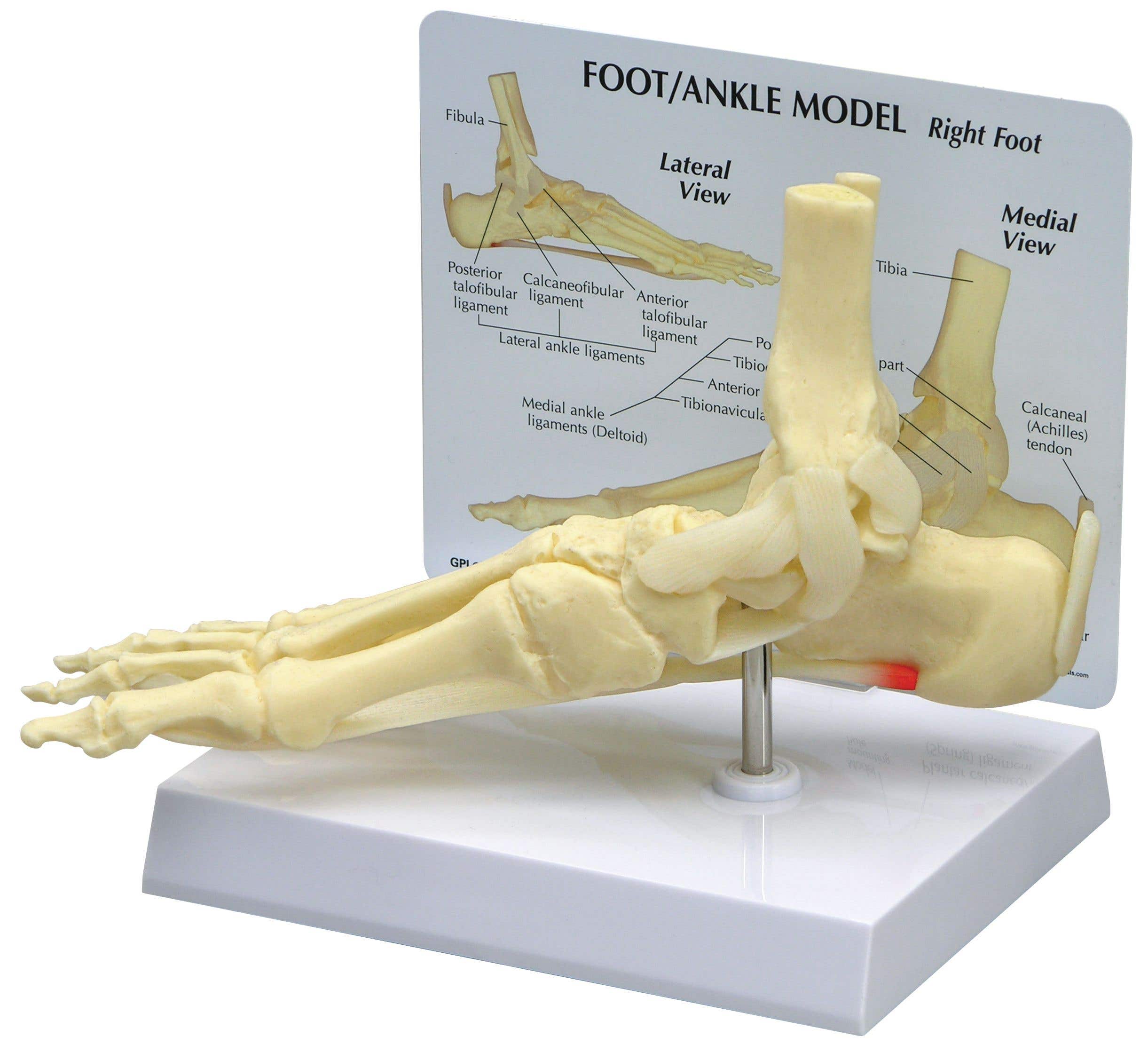 Ankle/FootPlantarFasciitiswithKeyCard