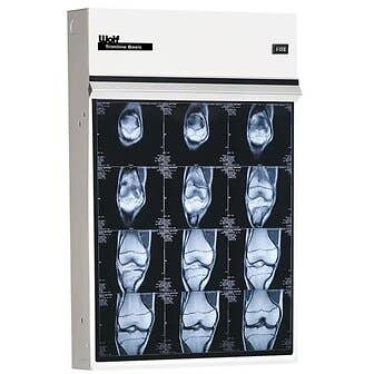 X-Ray