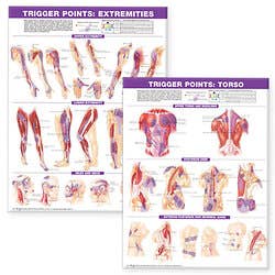 Laminated Trigger Points, Torso And Extremities