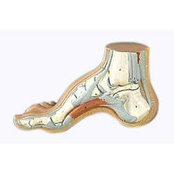 Hollow Foot