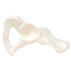 Hip Bone, Right
